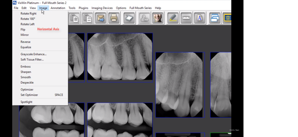screenshot of Gendex VixWin Platinum